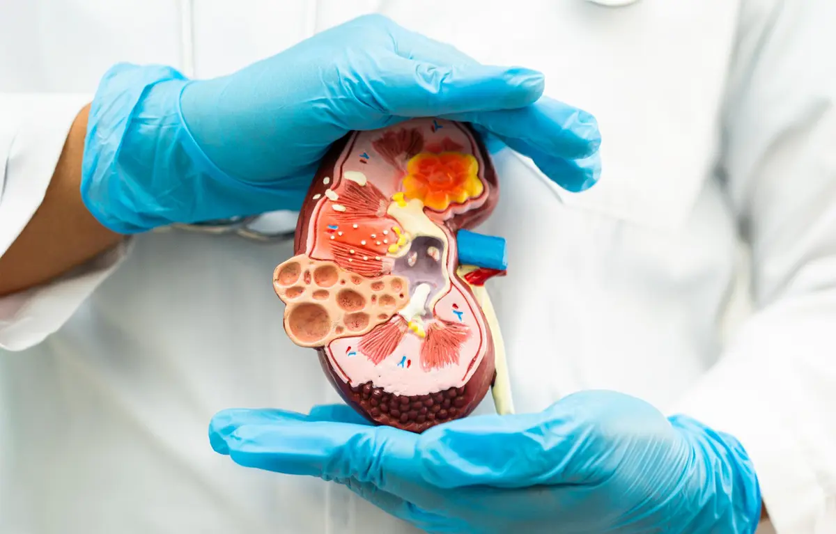 Anatomski prikaz presjeka bubrega u krupnom planu u rukama liječnika s medicinskim rukavicama; prof. dr. sc. Danica Galešić Ljubanović objašnjava bolest glomerula bubrega, takozvani filter bubrega